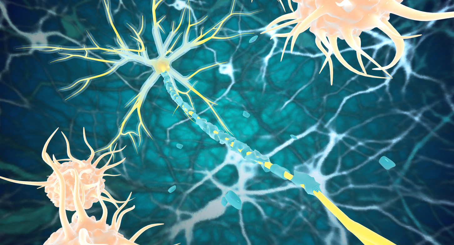 Remyelination is the phenomenon in which new myelin sheaths are produced around axons in the central nervous system.